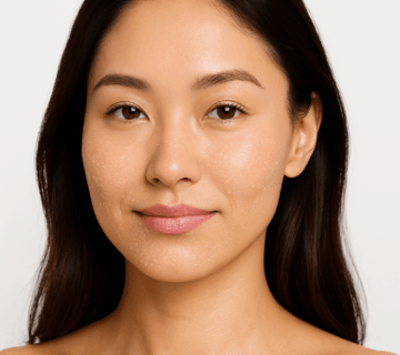 Close-up of a Korean woman with dry, flaky skin on cheeks and lips, illustrating the need for the best moisturiser for dry skin.